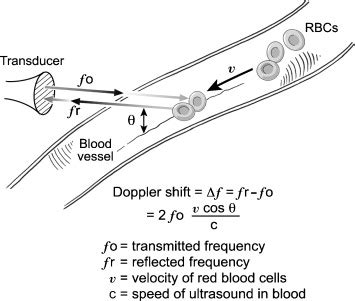 Doppler echocardiography: A contemporary review.